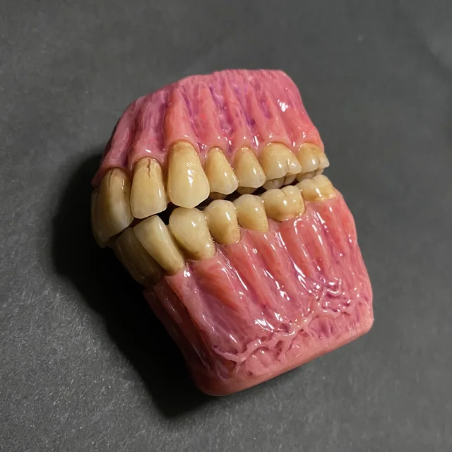 歯と歯根をあしらった、蓋を閉じた状態の特注ZIPPOライター